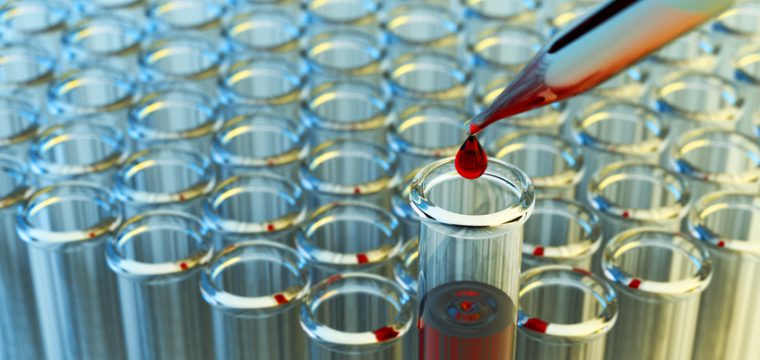 The O-Shot® and Other Uses of PRP (Platelet-Rich Plasma)